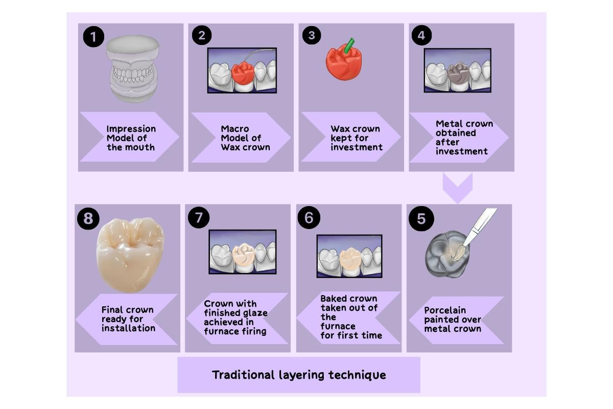 Mastering Precision in Dentistry: The Instrument for Tapering and Wax Melting